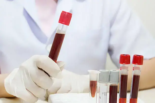 MCHC Blood Test